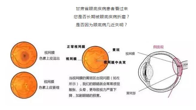 9月1日廣州中山大學(xué)眼科教授張少沖來蘭會診