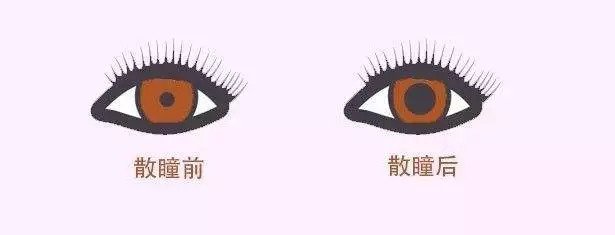 配眼鏡還散瞳，散瞳對眼睛有傷害嗎